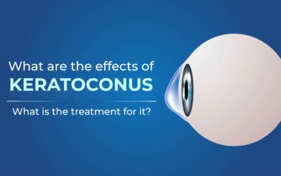 What are the effects of Keratoconus And what is the treatment for Keratoconus-Global-Eye-Hospital