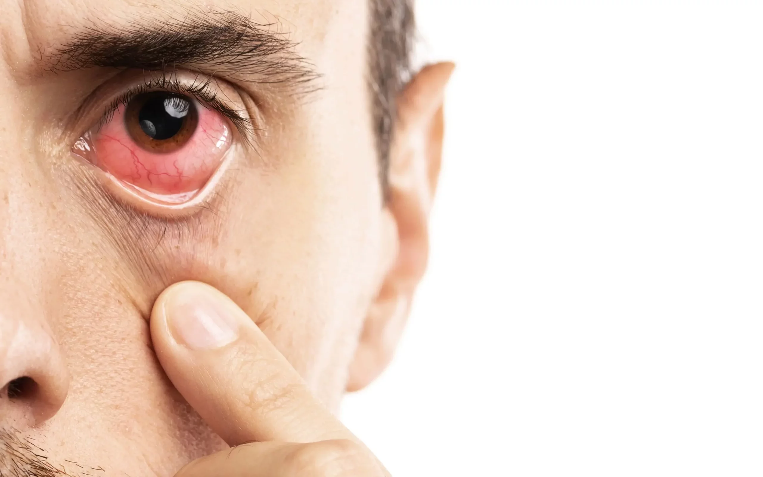 Things You Should Know Before Getting Punctal Plug Insertion - Dry Eyes - Global Eye Hospital