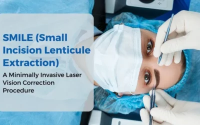 SMILE (Small Incision Lenticule Extraction) - Global Eye Hospital