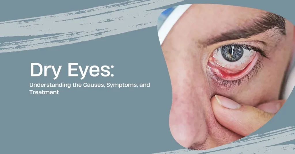 Dry Eyes Understanding the Causes Symptoms and Treatment-Global-Eye-Hospital