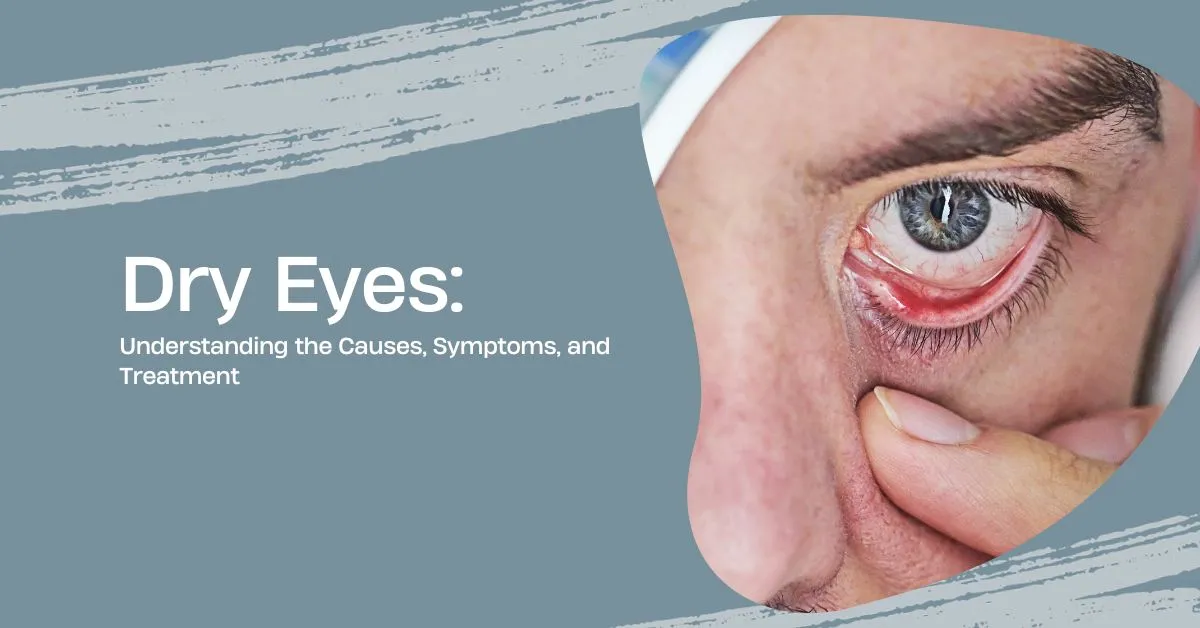 Dry Eyes Causes, Symptoms, and Treatment Global Eye Hospital