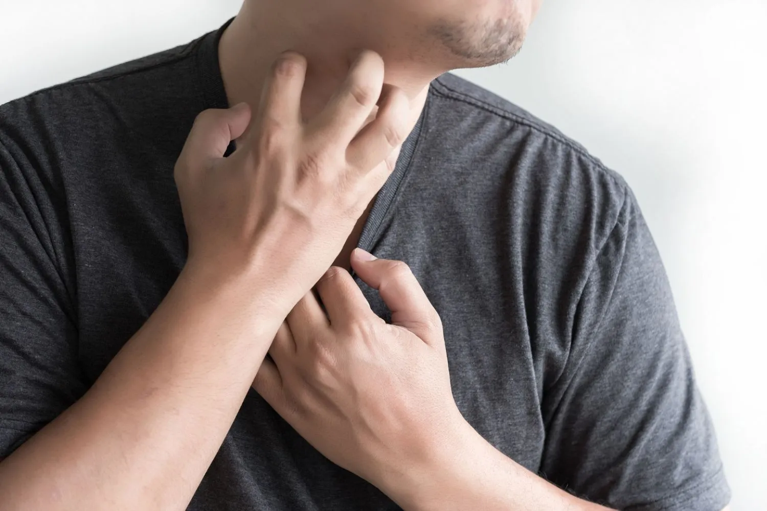 Battling Pollen Allergy The Struggle with Irritable, Itchy, and Red Eyes